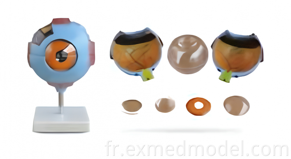 Enlarged Eyeball Anatomy Model